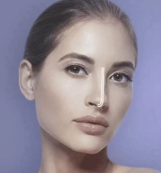 SOLE RHINOPLASTY METHOD-PharoDerma aesthetic products for health care